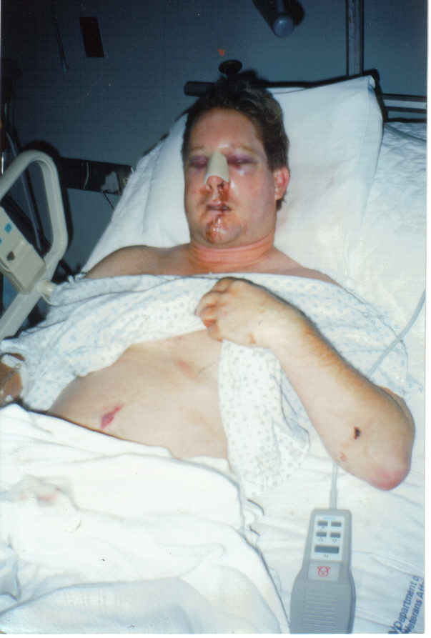 Tom hospital 0598 closer